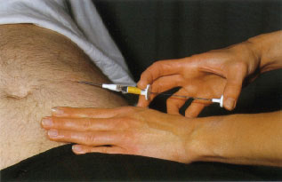 Testosterone injection site reaction
