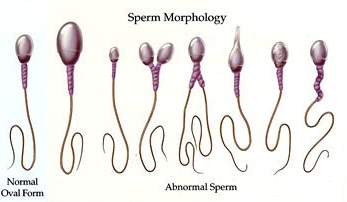 Monte recommends best of Infrequent ejacualtion causes poor sperm morphology Nude photos Mai lin pornstar