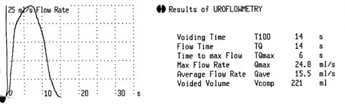 normal uroflow pattern