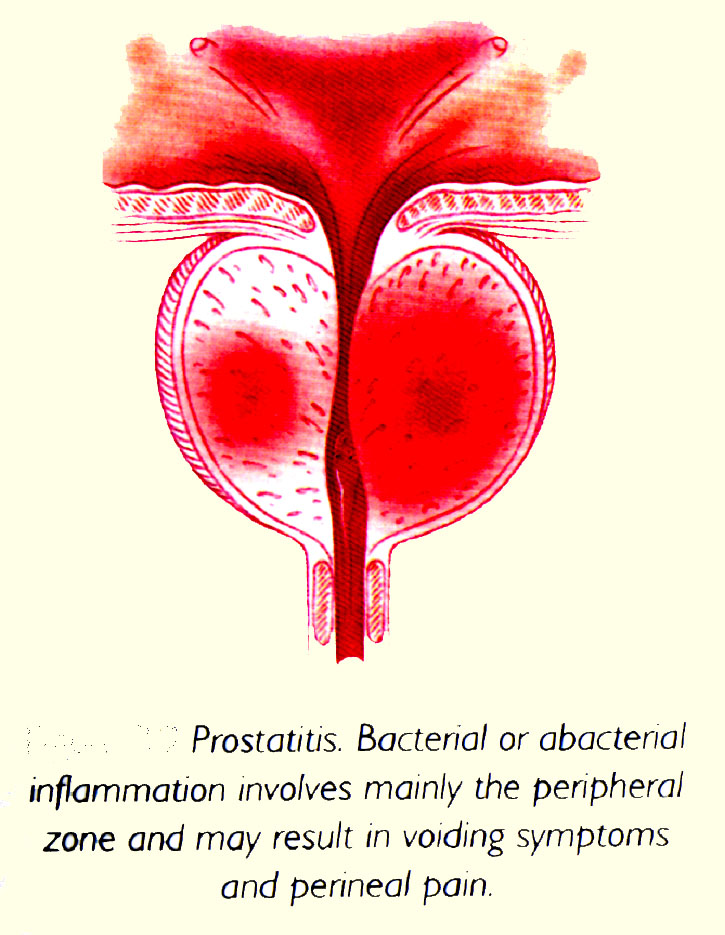 Urinary Tract Infection Chin Chong Min Urology Symptoms of Urinary