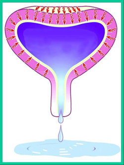 Picture of Urinary Incontinence