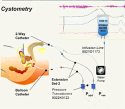 Picture of Urinary Incontinence