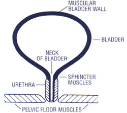 urinary incontinence treatment