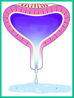 Urge incontinence