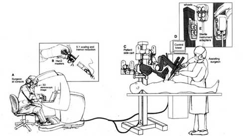 Robotic Radical Prostatectomy
